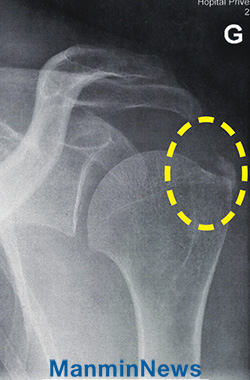 X-ray�Կ����