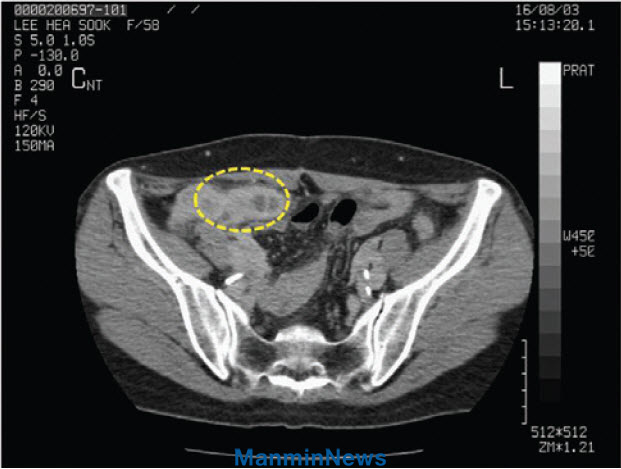 CT�Կ�
