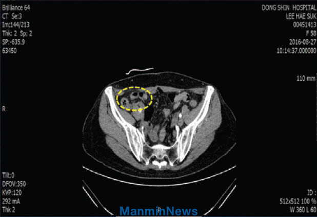 CT�Կ�