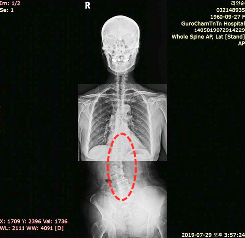 X-ray�Կ�