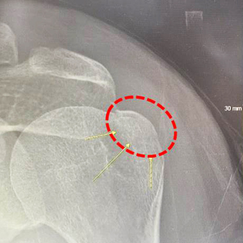 �⵵�ޱ���